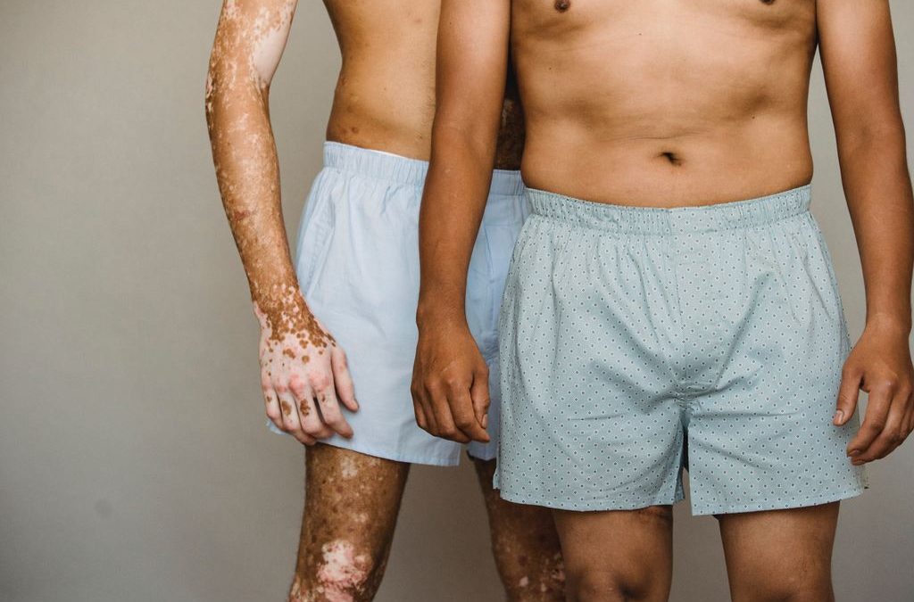 Psorijeza – Kako stati na kraj ovoj kožnoj bolesti?