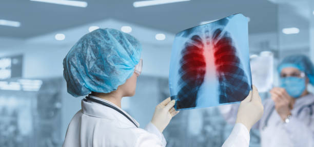 Približno o upali pluća: prepoznavanje ključnih indikacija