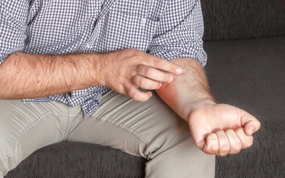 Da li psorijaza svrbi više noću ili danju?