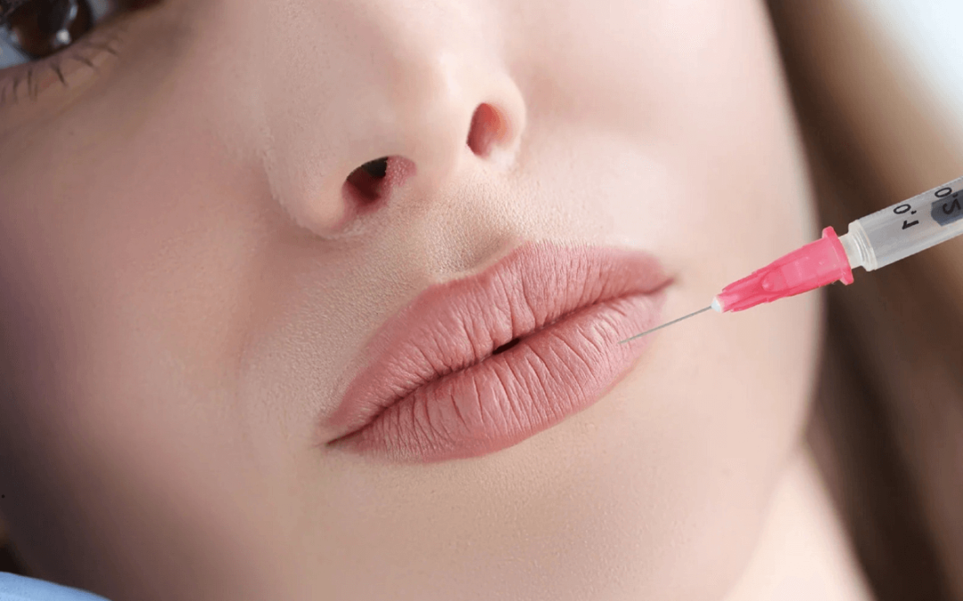 Suptilna promjena, snažan osjećaj: kako povećanje usana utječe na samopouzdanje